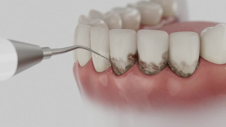 Trusted Dental Implants service in Milton, FL - Dentist Open Now